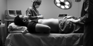 Liposuction for Love Handles