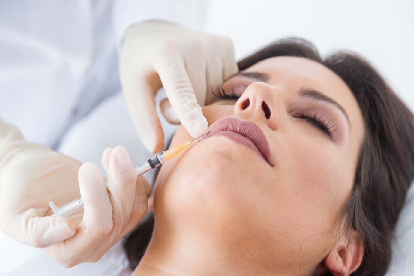 Lip Fillers in Kerala